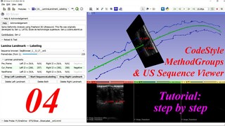 Code Style, Method Groups & US Sequence Viewer -- 3D Slicer Extension Development Tutorial #04