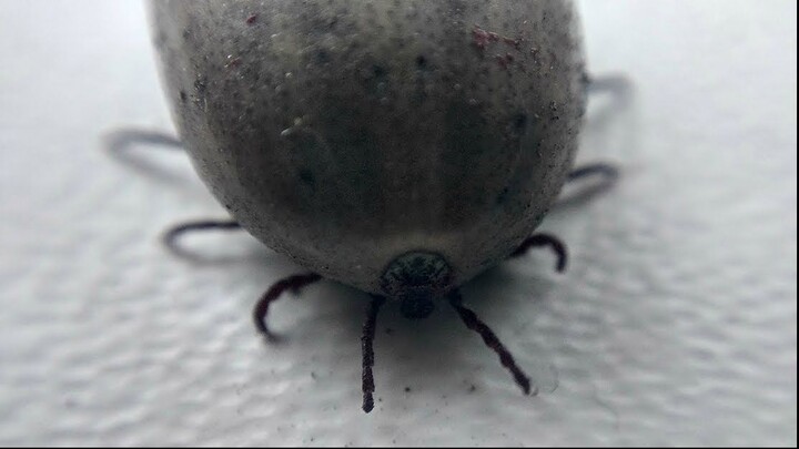 Huge tick under the microscope