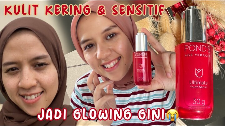 Review Serum untuk kulit kering & kusam |Ponds Age Miracle Ultimate Youth Serum Untuk kulit sensitif