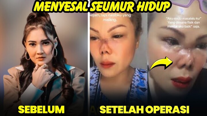 Hasil tak sesuai harapan, 8 artis mengaku menyesal lakukan operasi hidung