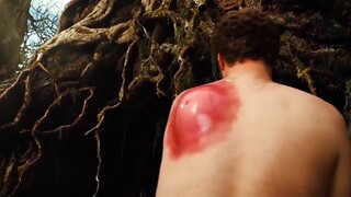 "Have you ever seen a mosquito bite bigger than your head?"