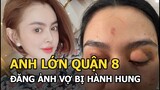 “Anh lớn quận 8” đăng ảnh vợ bị shop Trang Nemo hà.nh hu.ng, nói 1 câu ấm áp