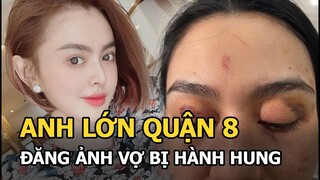 “Anh lớn quận 8” đăng ảnh vợ bị shop Trang Nemo hà.nh hu.ng, nói 1 câu ấm áp