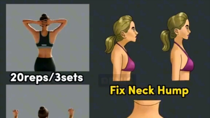 Exercise for good posture