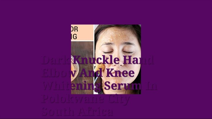 Get Rid Of Vitiligo In Titusville City in Florida [27710732372] Knee Whitening Serum In South Africa