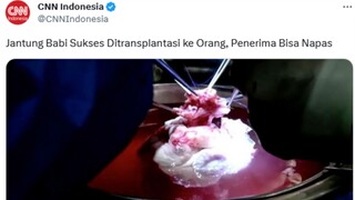 Dia beneran mengganti jantungnya dengan jantung BABI...