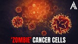 Are ‘Zombie’ Cancer Cells Why the Disease Sometimes Returns?