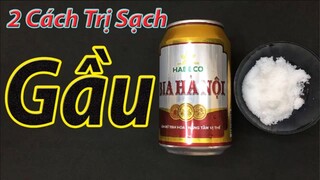 2 cách trị gầu tại nhà hiệu quả nhanh nhất bằng nguyên liệu sẵn có, an toàn cho da đầu và tóc