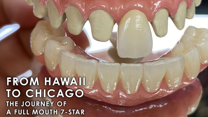 From Hawaii to Chicago: The Journey of a Full Mouth 7-Star