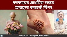 ক্যান্সারের ঝুঁকি এড়াতে প্রাথমিক লক্ষণগুলো চিনে রাখুন। Cancer er lokkhon gulo ariye jaben na
