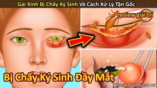 Nhím Cute Review Gái Xinh bị chấy ký sinh và cách diệt tận gốc || Review Giải Trí Đời Sống