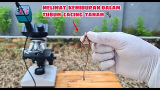 ZOOM 1000X: KEHIDUPAN DALAM PERUT CACING TANAH