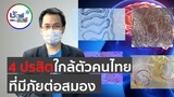 ชัวร์ก่อนแชร์ FACTSHEET : 4 ปรสิตใกล้ตัวคนไทย ที่มีภัยต่อสมอง