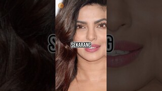 Rahasia Operasi Plastik Hidung Priyanka Chopra yang Bikin Wajahnya Makin Cantik #shorts #foryou #new