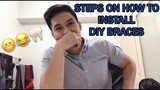 PAANO MAGKABIT NG DIY BRACES | HOW TO PUT DIY BRACES (SIMPLE AND EASY)
