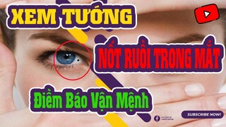 Nốt Ruồi Trong Mắt, Tốt Hay Xấu, Là Điềm Báo Vận Mệnh Cho Chủ Nhân