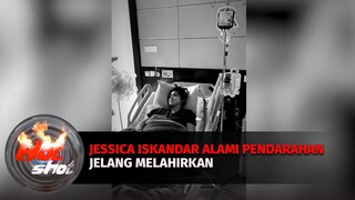 Jessica Iskandar Alami Pendarahan Jelang Melahirkan | Hot Shot