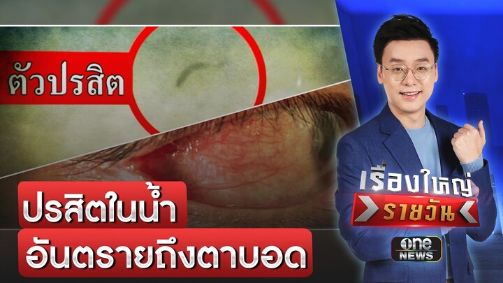 ปรสิตในน้ำ อันตรายถึงตาบอด | เรื่องใหญ่รายวัน | สำนักข่าววันนิวส์