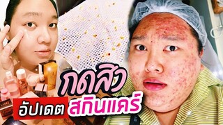 เป็นสิวช่วงโควิด พาทัวร์กดสิวจุกๆ อัปเดต Skincare Night Routine | จือปาก