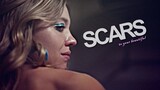 ►cassie howard | scars to your beautiful
