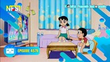 Doraemon Episode 457B "Tombol Pengganti Ruangan" Bahasa Indonesia NFSI