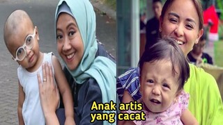 Lumpuh Otak Hingga Katarak! Inilah Deretan Artis Punya Anak Penderita Sakit Mematikan