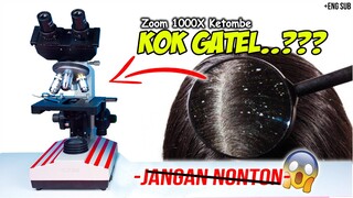 MAKHLUK HALUS DI KETOMBE KITA | Dundruff in Microscope Zoom 1000X