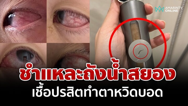 ขีดเส้นอีก 5 วัน!สั่งคอนโดเร่งฆ่า "เชื้อปรสิต" ให้เสร็จทั้งระบบ หากไม่ทำจะดำเนินคดี | อมรินทร์อัปเดต