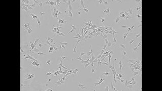 iPSC derived neural crest cell proliferation time-lapse | Using CytoSMART Lux2 live-cell imager