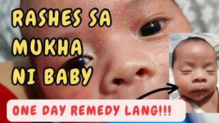 RASHES SA MUKHA ni baby| NEONATAL ACNE| REMEDY by Dr. Pedia Mom