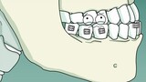 ฟันบนและฟันล่างสามารถเรียงชิดกันได้ในที่สุด