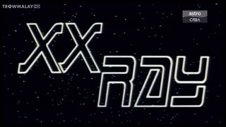 XX Ray 1992