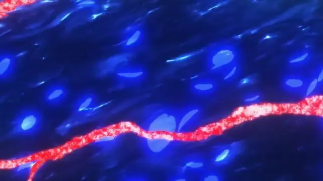 One Piece Movie 9 Bloom In The Winter Miracle Sakura Bilibili