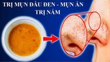 TRỊ MỤN ẨN, MỤN ĐẦU ĐEN, DA SẦN SÙI, NÁM, TÀN NHANG, VIÊM NANG LÔNG - Remove Blackheads PERMANENTLY