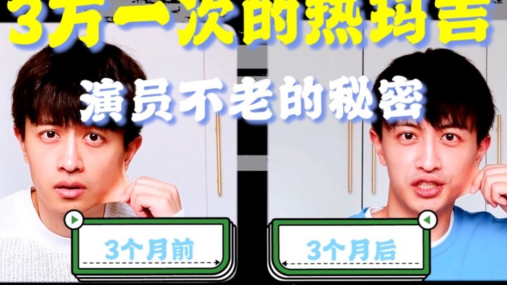 【演员不老的秘密】3万多1次的热玛吉，3个月后瘦脸紧致效果惊人！医美赛高！