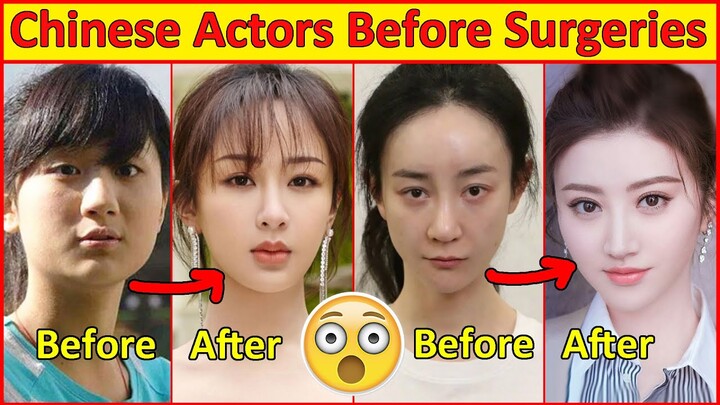 Chinese Actors Before and After Plastic Surgeries 😮 , Incredible Changes, Chinese Drama