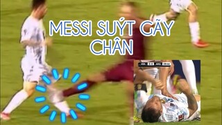 MESSI SUÝT GÃY CHÂN