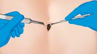 Immersive belly button cleaning