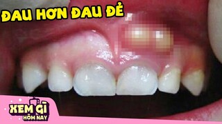 GÃY "c.u" & 8 Bệnh Lý ĐA.U ĐỚ.N nhất VƯỢT Giới Hạn Chịu Đựng của Loài người | Xem gì hôm nay