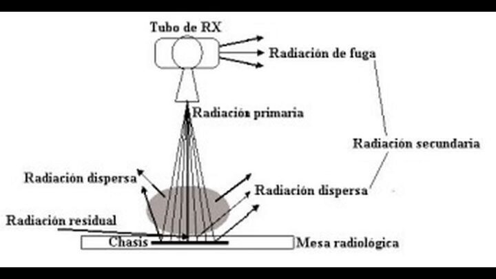 La interpretación diagnóstica de RAYOS X