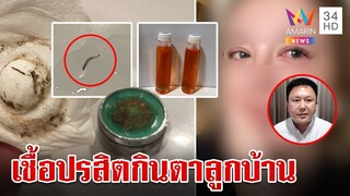 สยองทั้งคอนโด!ปรสิตในน้ำกินตาลูกบ้านนับ 100  บางรายหวิดตาบอด | ทุบโต๊ะข่าว | 9/7/67