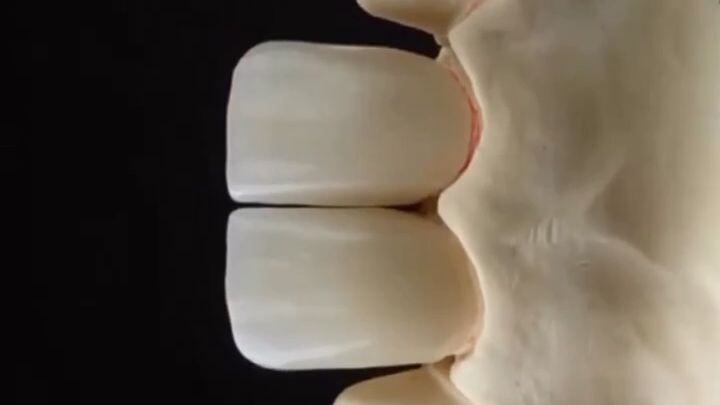 Dental Cap