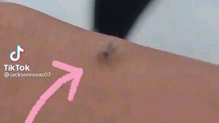 maling dugo nainom mo may alak lasing ka ngayon 😁😆🤣