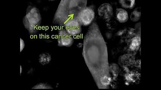 Label-free Live Cell Imaging: T-cells killing cancer cells - zoomed-in