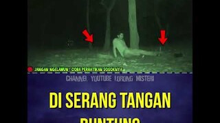 DI SERANG TANGAN BUNTUNG #shorts