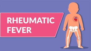 Rheumatic Fever