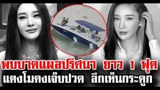 พ บ แ ผ ล ป ริ ศ น า ยาว 1 ฟุต บริเว ณ ต้ น ข า แตงโม นิดา