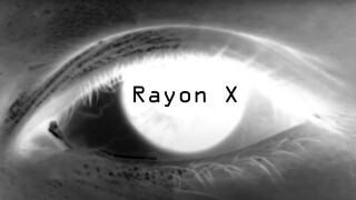 Rayon X - un projet GOBELINS X MSF