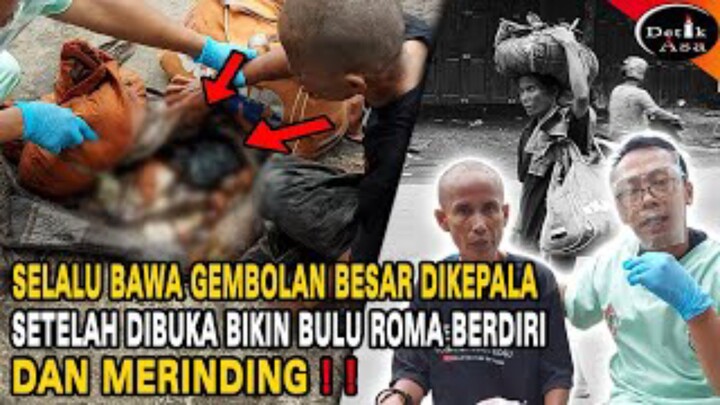 ODGJ Selalu bawa Gerombolan Besar