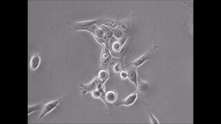 time-lapse: OSCC cell (total 25.1 hrs)